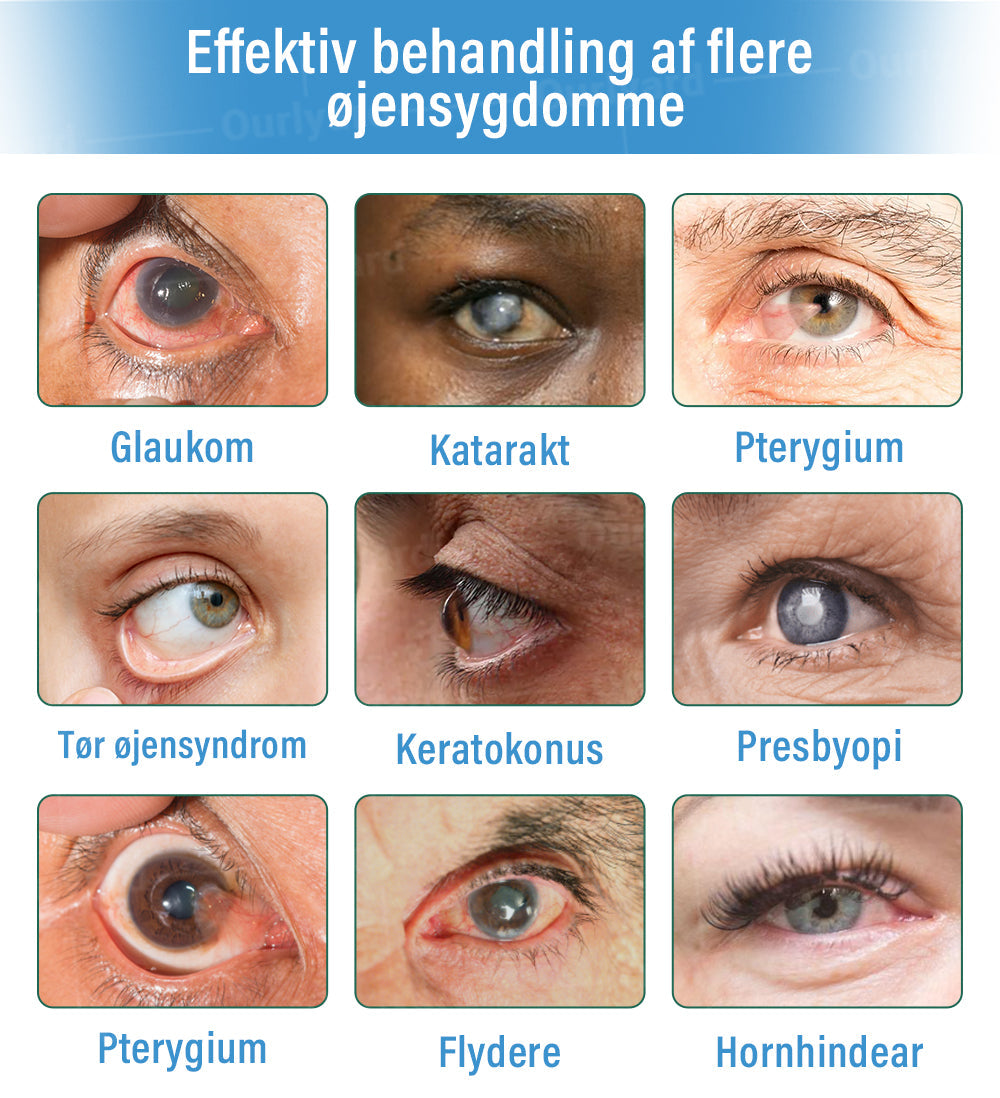 👩⚕️Ourlyard® Supramolekylære Øjendråber ✅Godkendt af Lægemiddelstyrelsen (Velegnet til grå stær, svævende pletter, AMD, tørre øjne og presbyopi)